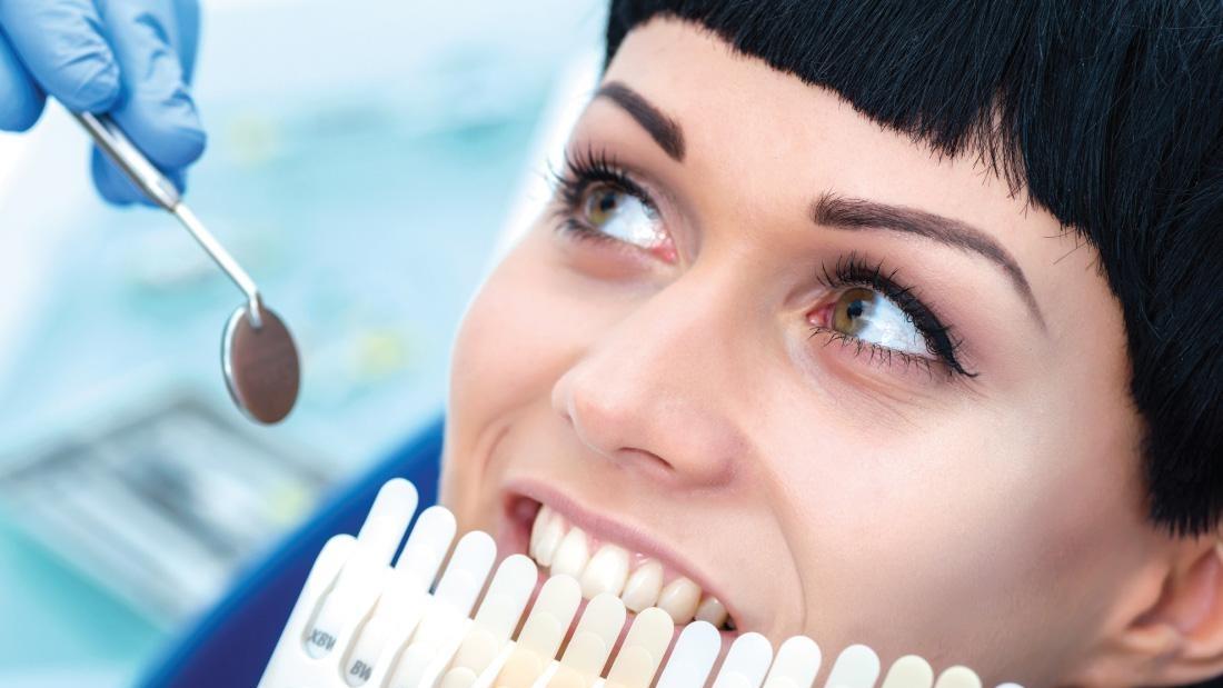 Why Professional Teeth Whitening Is Best Teeth Whitening Tampa FL