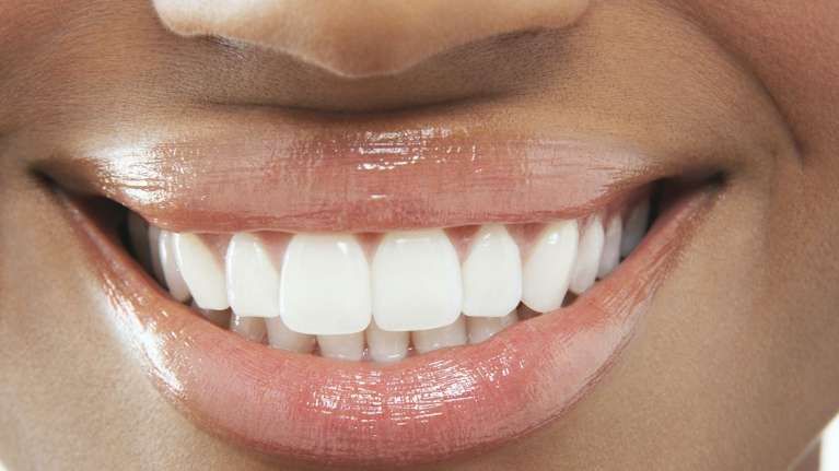 clean white teeth