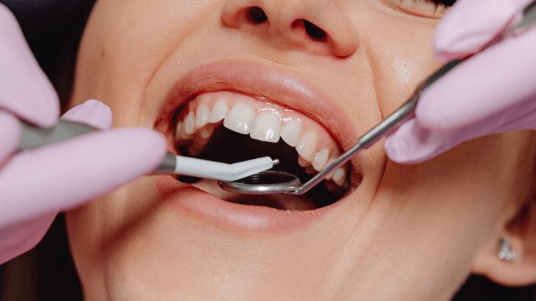 A dentist carefully examines a patient's teeth during a routine check-up.