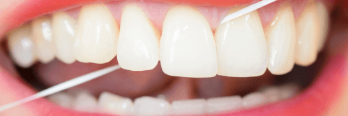 Flossing helps remove food and plaque from between your teeth.
